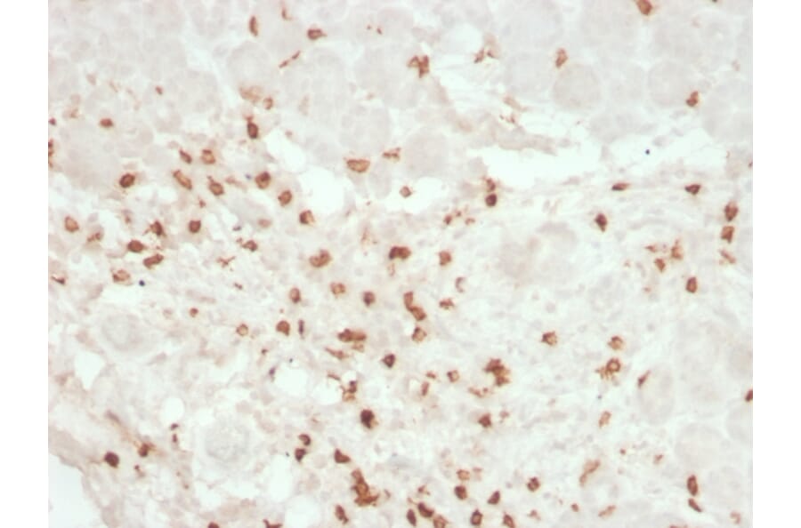 Immunohistochemistry - Anti-CD8A Antibody [rC8/468] - BSA and Azide free (A253733) - Antibodies.com