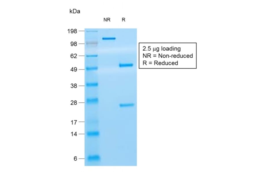 SDS-PAGE - Anti-CD8A Antibody [rC8/468] - BSA and Azide free (A253733) - Antibodies.com