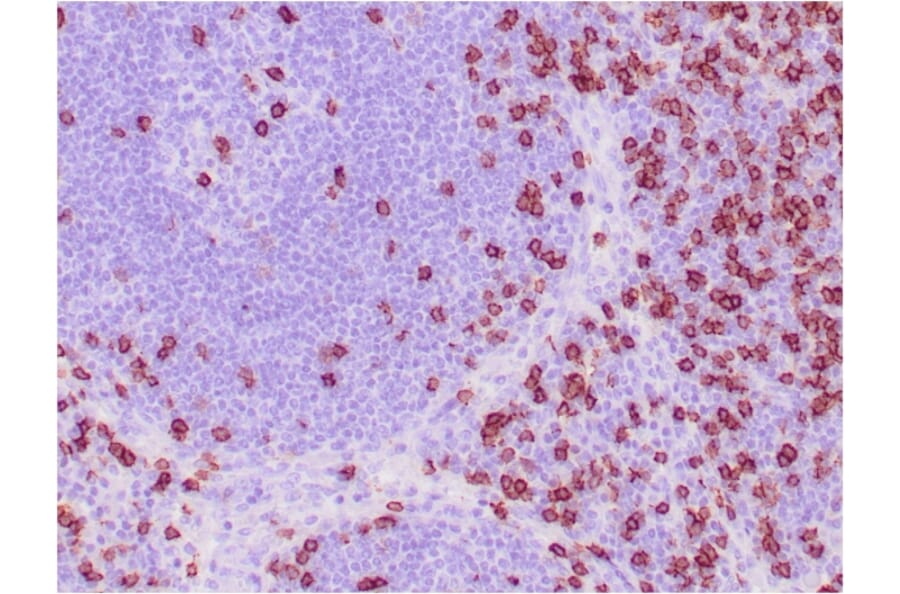 Immunohistochemistry - Anti-CD8A Antibody [C8/468] - BSA and Azide free (A253735) - Antibodies.com