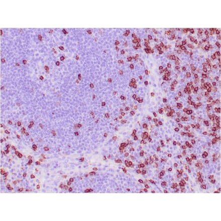 Immunohistochemistry - Anti-CD8A Antibody [C8/468] - BSA and Azide free (A253735) - Antibodies.com