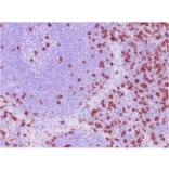 Immunohistochemistry - Anti-CD8A Antibody [C8/468] - BSA and Azide free (A253735) - Antibodies.com