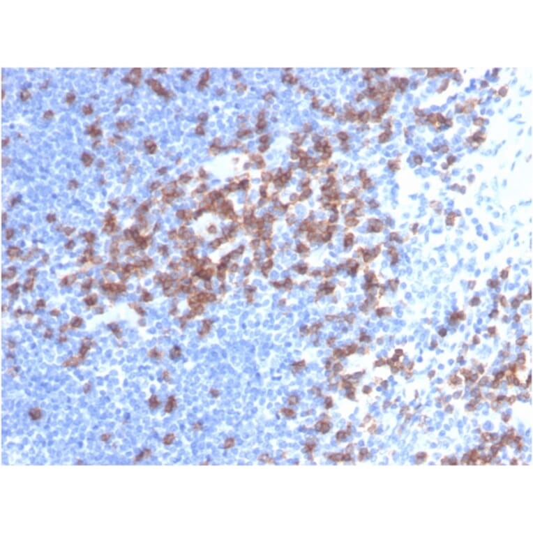 Immunohistochemistry - Anti-CD8A Antibody [C8/468] - BSA and Azide free (A253735) - Antibodies.com