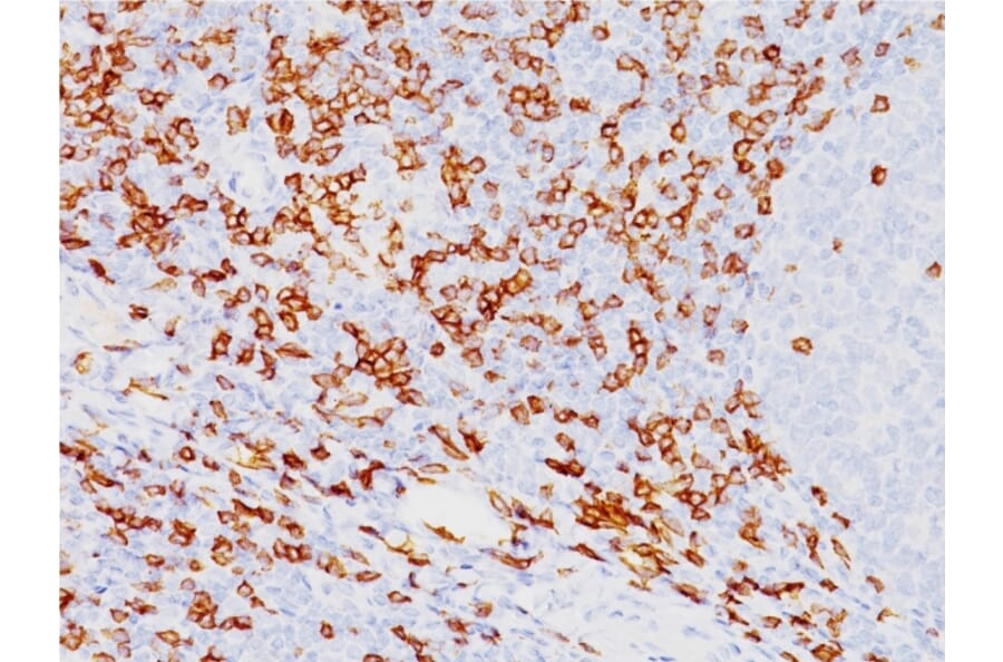 Immunohistochemistry - Anti-CD8A Antibody [SPM548] - BSA and Azide free (A253735) - Antibodies.com