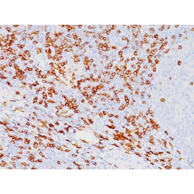 Immunohistochemistry - Anti-CD8A Antibody [SPM548] - BSA and Azide free (A253735) - Antibodies.com
