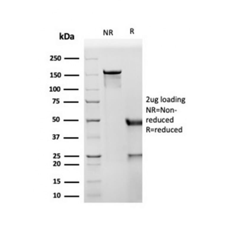 SDS-PAGE - Anti-CD8A Antibody [SPM548] - BSA and Azide free (A253736) - Antibodies.com