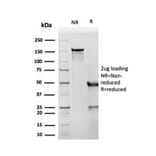 SDS-PAGE - Anti-CD8A Antibody [SPM548] - BSA and Azide free (A253736) - Antibodies.com