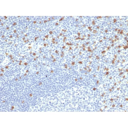 Immunohistochemistry - Anti-CD8A Antibody [rCD8/6590] - BSA and Azide free (A253737) - Antibodies.com