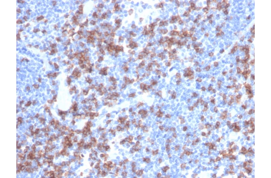 Immunohistochemistry - Anti-CD8A Antibody [rCD8/6590] - BSA and Azide free (A253736) - Antibodies.com