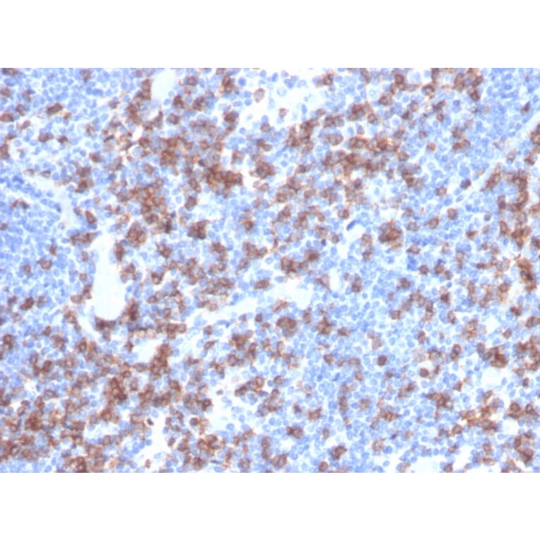 Immunohistochemistry - Anti-CD8A Antibody [rCD8/6590] - BSA and Azide free (A253736) - Antibodies.com