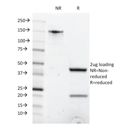 SDS-PAGE - Anti-CD8A Antibody [C8/1035] - BSA and Azide free (A253739) - Antibodies.com