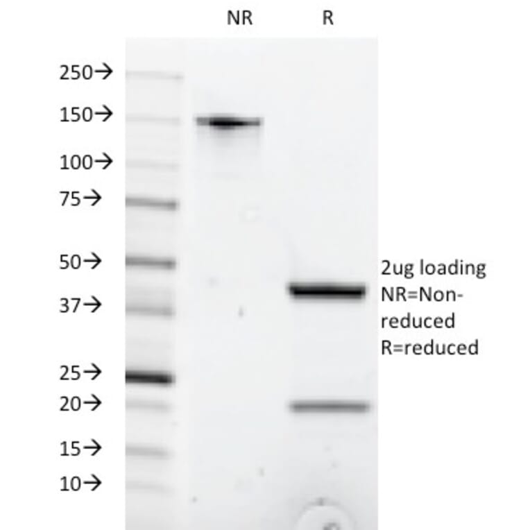 SDS-PAGE - Anti-CD8A Antibody [C8/1035] - BSA and Azide free (A253739) - Antibodies.com