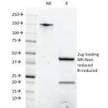 SDS-PAGE - Anti-CD8A Antibody [C8/1035] - BSA and Azide free (A253739) - Antibodies.com