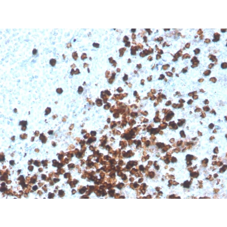 Immunohistochemistry - Anti-CD8A Antibody [CD8/4391R] - BSA and Azide free (A253743) - Antibodies.com