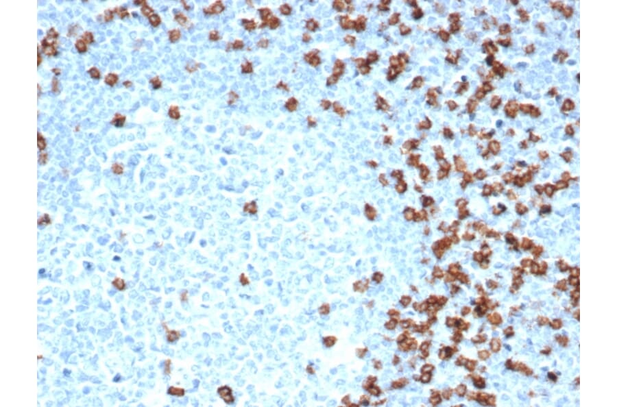 Immunohistochemistry - Anti-CD8A Antibody [CD8/4391R] - BSA and Azide free (A253743) - Antibodies.com