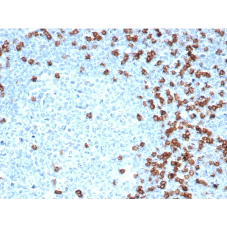 Immunohistochemistry - Anti-CD8A Antibody [CD8/4391R] - BSA and Azide free (A253743) - Antibodies.com