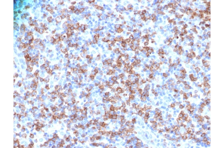 Immunohistochemistry - Anti-CD8A Antibody - BSA and Azide free (A253745) - Antibodies.com