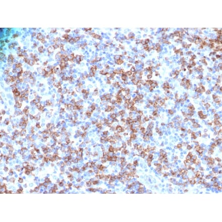 Immunohistochemistry - Anti-CD8A Antibody - BSA and Azide free (A253745) - Antibodies.com
