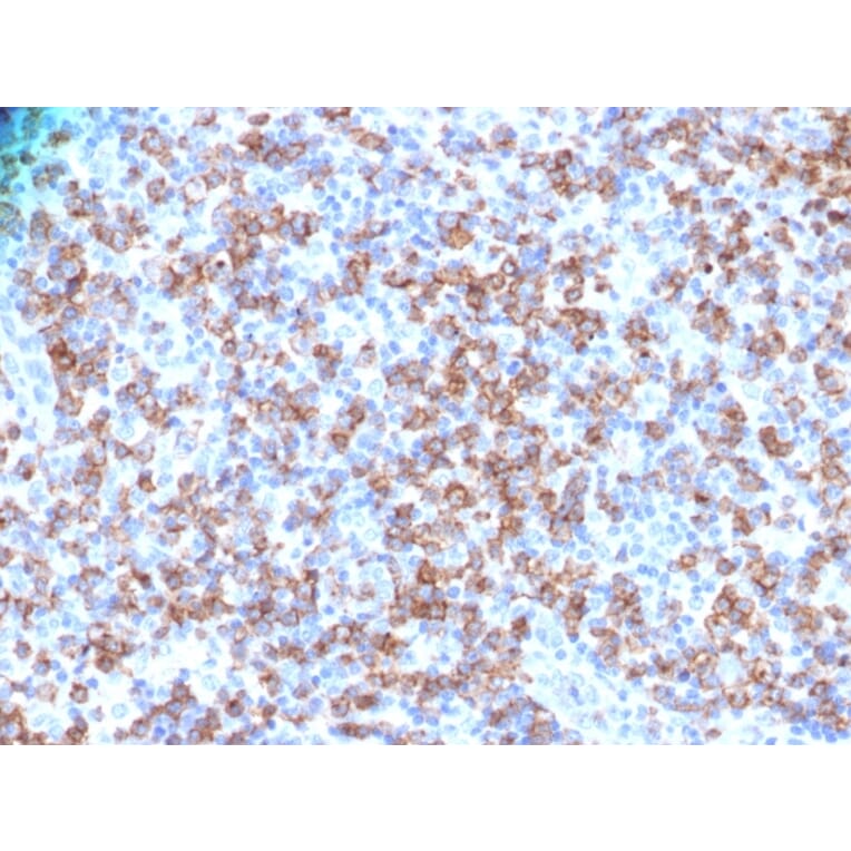 Immunohistochemistry - Anti-CD8A Antibody - BSA and Azide free (A253745) - Antibodies.com