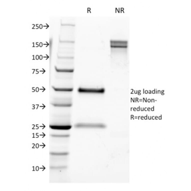 SDS-PAGE - Anti-CD9 Antibody [CD9/1631] - BSA and Azide free (A253752) - Antibodies.com
