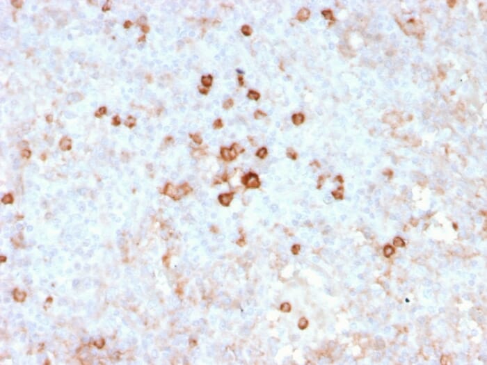 Recombinant Anti-CD14 Antibody [rLPSR/2408] (A253754)