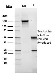 せらりp14 Recombinant Anti-CD14 Antibody [rLPSR/2408] (A253754)