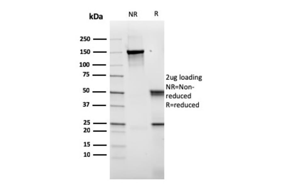 SDS-PAGE - Anti-CD14 Antibody [rLPSR/2408] - BSA and Azide free (A253754) - Antibodies.com