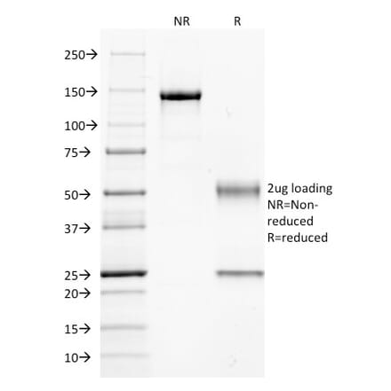 SDS-PAGE - Anti-CD14 Antibody [LPSR/654] - BSA and Azide free (A253757) - Antibodies.com