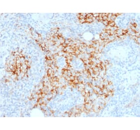 Immunohistochemistry - Anti-CD14 Antibody [LPSR/2385] - BSA and Azide free (A253759) - Antibodies.com