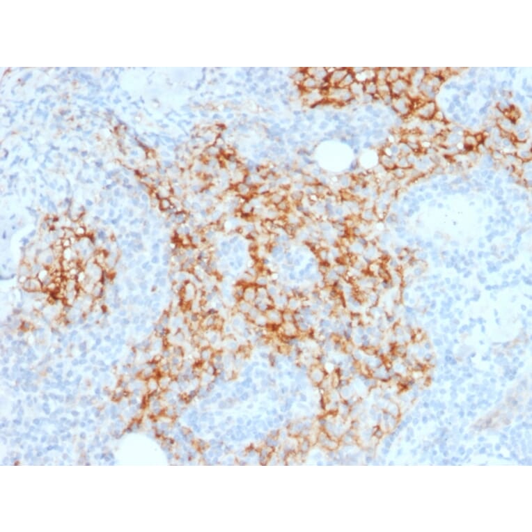 Immunohistochemistry - Anti-CD14 Antibody [LPSR/2385] - BSA and Azide free (A253759) - Antibodies.com