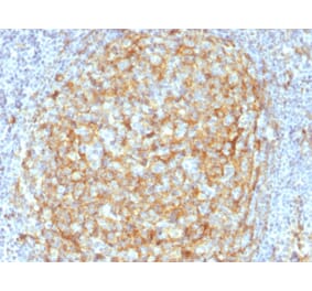 Immunohistochemistry - Anti-CD14 Antibody [LPSR/2386] - BSA and Azide free (A253760) - Antibodies.com