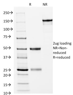 Anti-CD14 Antibody [LPSR/2397] (A253761) | Antibodies.com