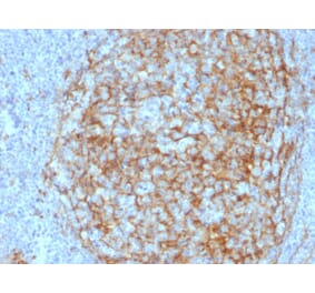 Immunohistochemistry - Anti-CD14 Antibody [LPSR/2408] - BSA and Azide free (A253762) - Antibodies.com
