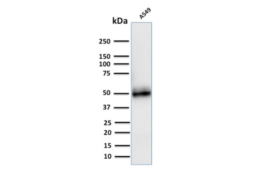 Western Blot - Anti-CD14 Antibody [LPSR/2408] - BSA and Azide free (A253762) - Antibodies.com