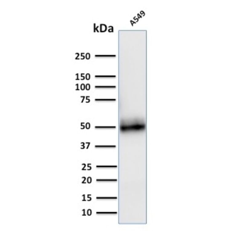 Western Blot - Anti-CD14 Antibody [LPSR/2408] - BSA and Azide free (A253762) - Antibodies.com