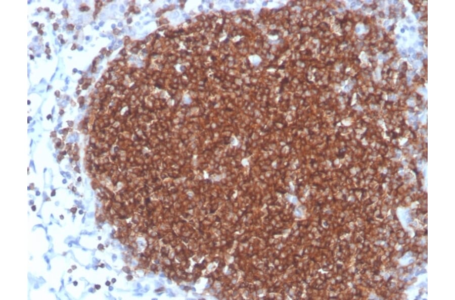 Immunohistochemistry - Anti-CD19 Antibody [rCD19/4591] - BSA and Azide free (A253764) - Antibodies.com