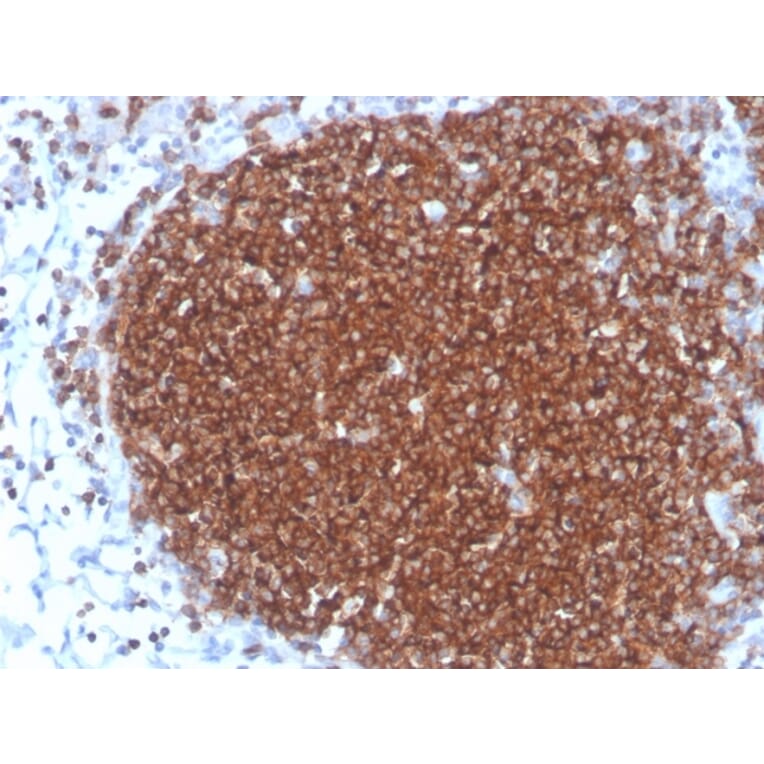 Immunohistochemistry - Anti-CD19 Antibody [rCD19/4591] - BSA and Azide free (A253764) - Antibodies.com