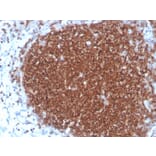 Immunohistochemistry - Anti-CD19 Antibody [rCD19/4591] - BSA and Azide free (A253764) - Antibodies.com