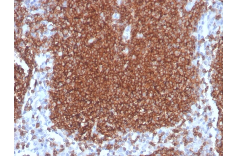 Immunohistochemistry - Anti-CD19 Antibody [rCD19/4591] - BSA and Azide free (A250584) - Antibodies.com