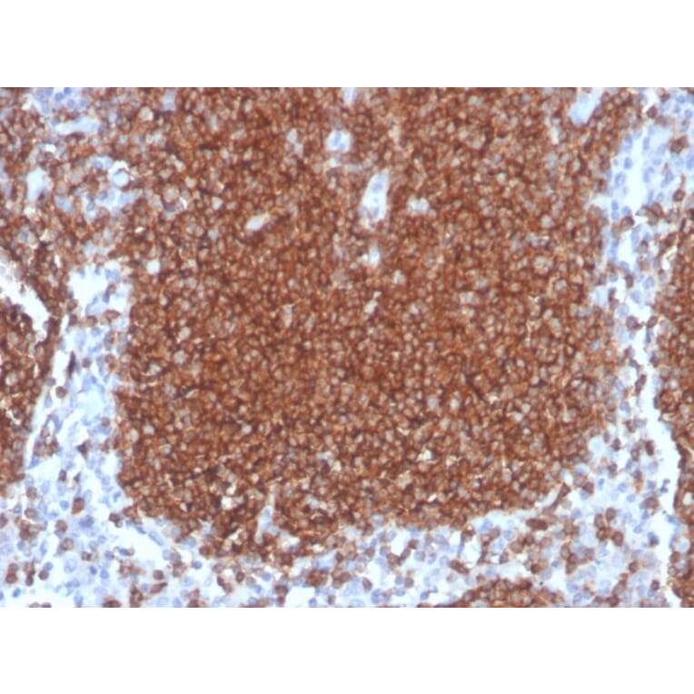 Immunohistochemistry - Anti-CD19 Antibody [rCD19/4591] - BSA and Azide free (A253763) - Antibodies.com