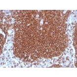 Immunohistochemistry - Anti-CD19 Antibody [rCD19/4591] - BSA and Azide free (A253763) - Antibodies.com