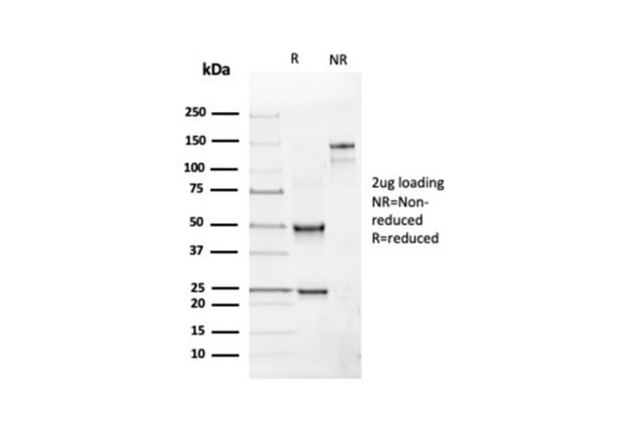 SDS-PAGE - Anti-CD19 Antibody [rCD19/4591] - BSA and Azide free (A250584) - Antibodies.com