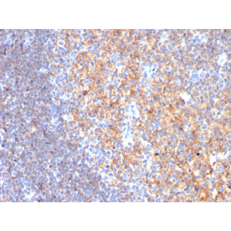Immunohistochemistry - Anti-CD19 Antibody [CD19/3116] - BSA and Azide free (A253768) - Antibodies.com