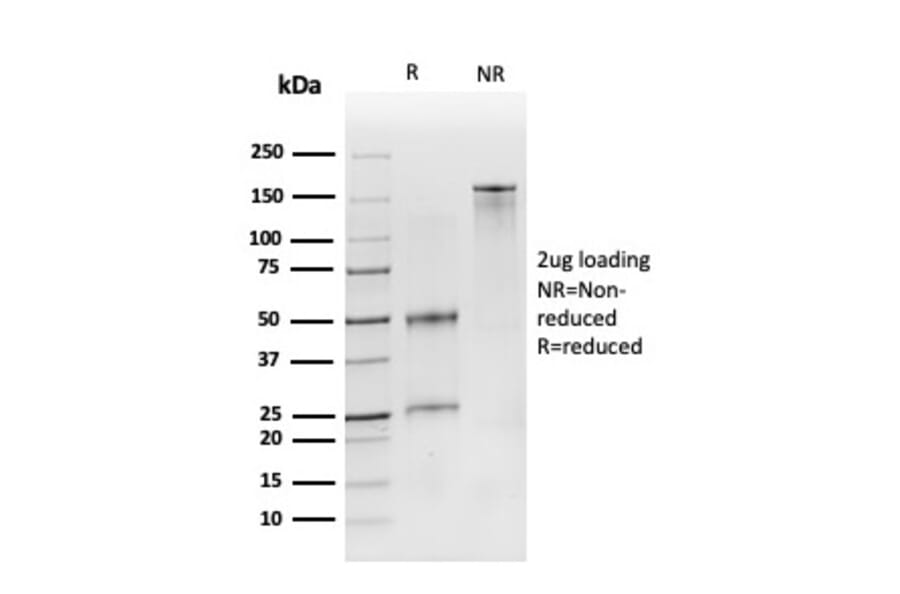 SDS-PAGE - Anti-CD19 Antibody [CD19/3116] - BSA and Azide free (A253768) - Antibodies.com