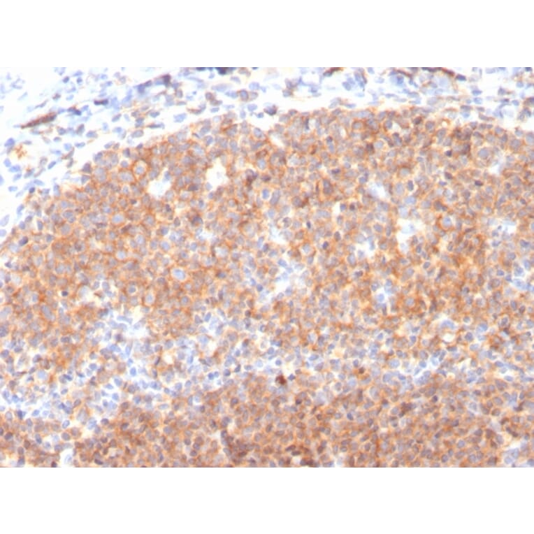 Immunohistochemistry - Anti-CD19 Antibody [CD19/3117] - BSA and Azide free (A253769) - Antibodies.com