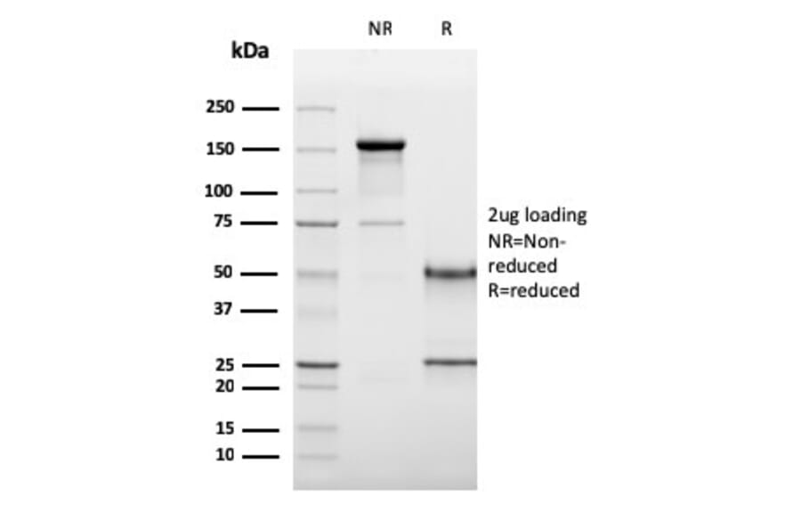 SDS-PAGE - Anti-CD19 Antibody [CD19/3117] - BSA and Azide free (A253769) - Antibodies.com
