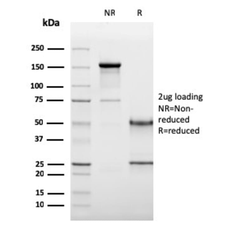 SDS-PAGE - Anti-CD19 Antibody [CD19/3117] - BSA and Azide free (A253769) - Antibodies.com