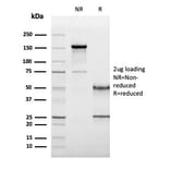 SDS-PAGE - Anti-CD19 Antibody [CD19/3117] - BSA and Azide free (A253769) - Antibodies.com