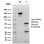 SDS-PAGE - Anti-CD20 Antibody [MS4A1/3410] - BSA and Azide free (A253770) - Antibodies.com