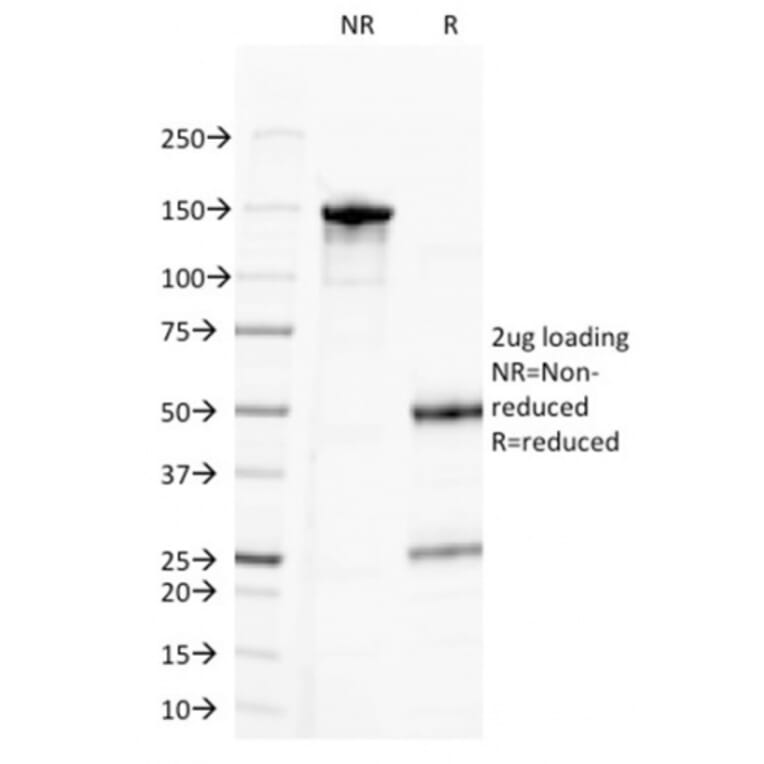 SDS-PAGE - Anti-CD20 Antibody [MS4A1/3411] - BSA and Azide free (A253771) - Antibodies.com