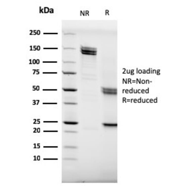 SDS-PAGE - Anti-CD20 Antibody [MS4A1/3409] - BSA and Azide free (A253772) - Antibodies.com
